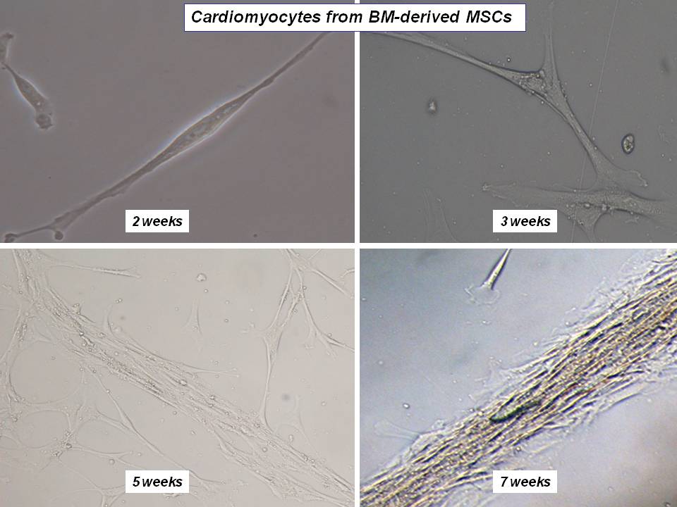 Cardiomiocitos de MSC derivados de BD