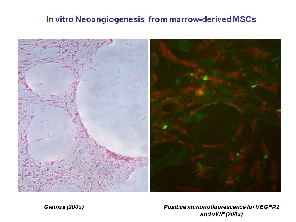 In vitro, Neoangiogénesis, a partir de Células madre mesenquimales derivadas de médula ósea