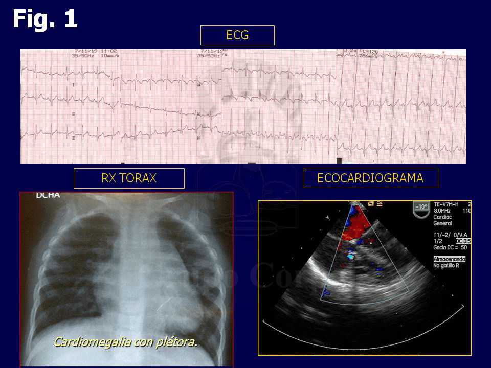 Imágenes electrocardiográficas, radiológicas y ecográficas al ingreso.